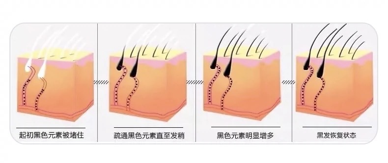 [해외직구]염색 에센스 1개